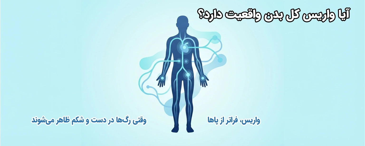 آیا واریس فقط محدود به پاهاست؟ بررسی درگیری سایر نواحی بدن
