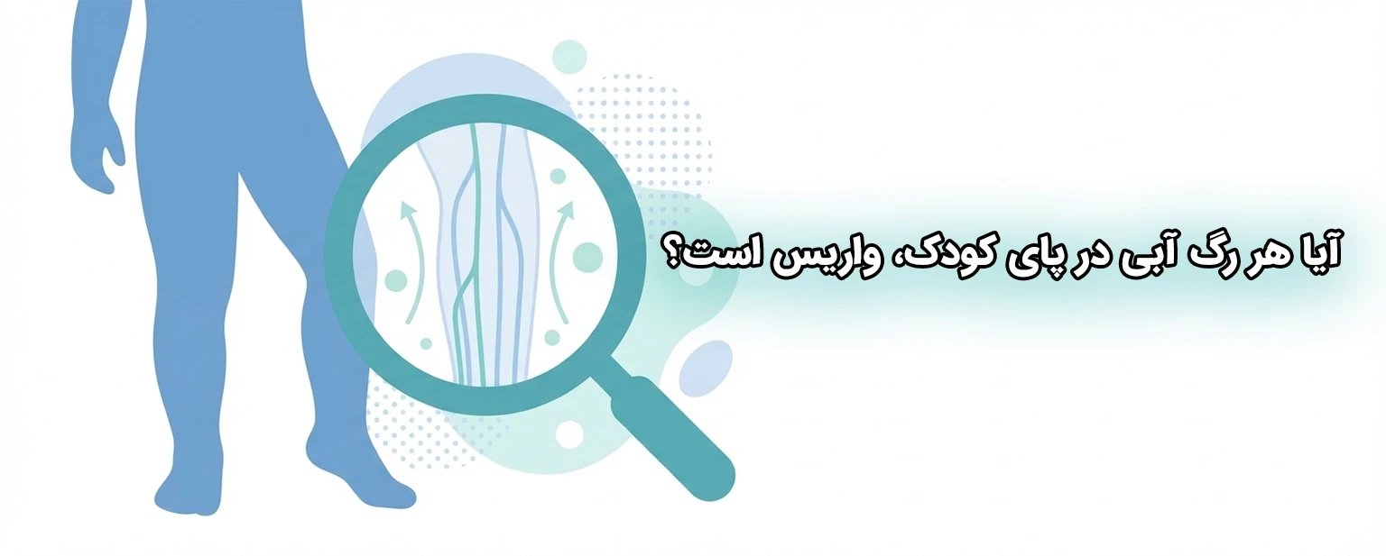 آیا واریس در کودکان می‌تواند نشانه یک مشکل جدی باشد؟