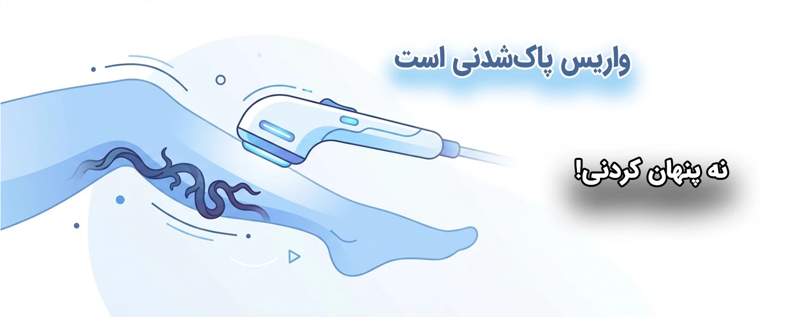 درمان واریس پا؛ واریس را چگونه درمان کنیم؟