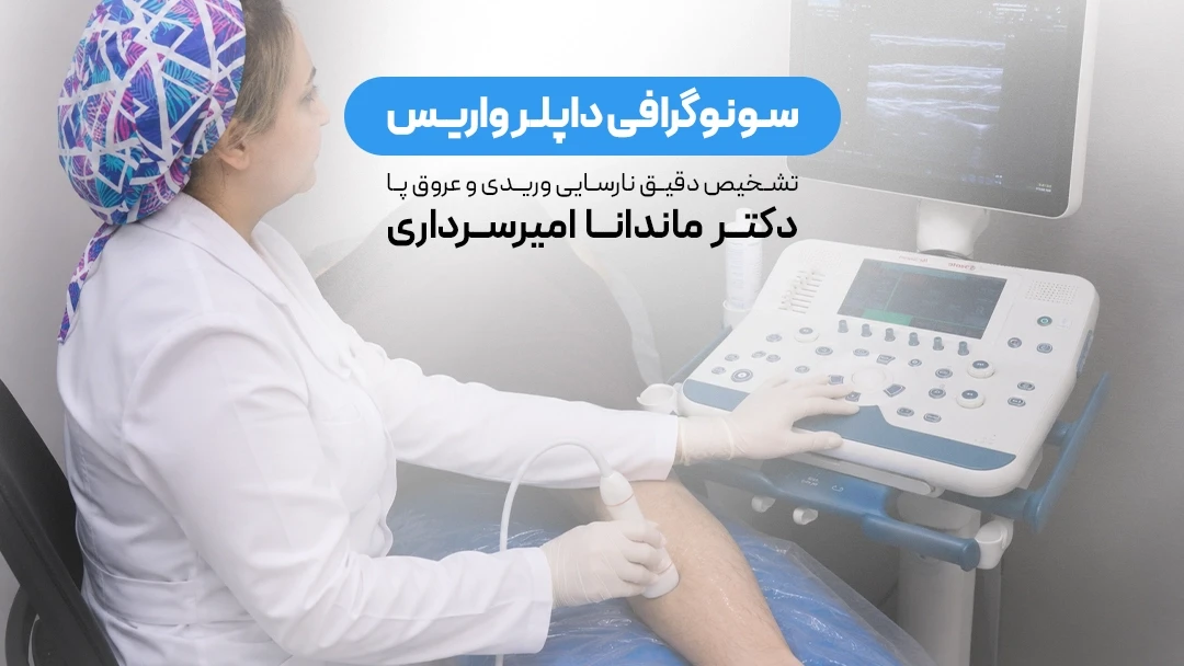 سونوگرافی داپلر واریس