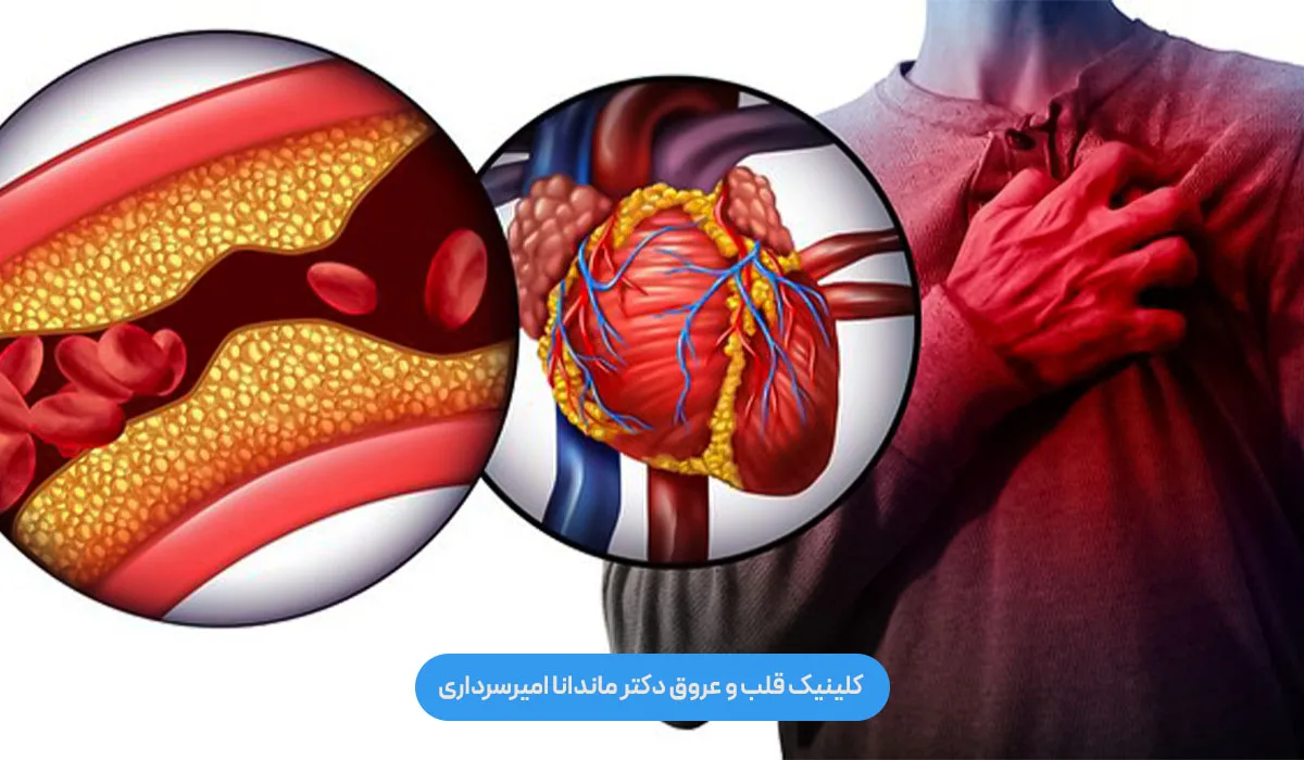 نقش استرس در بروز سکته قلبی چیست؟