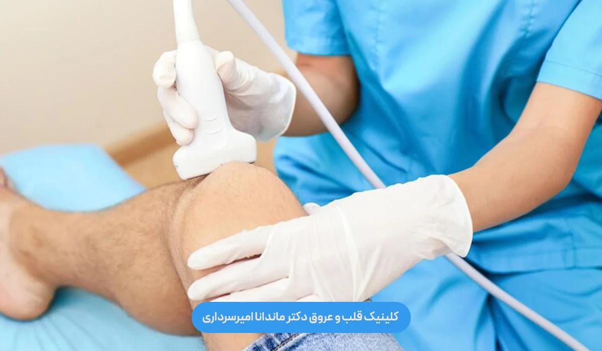 لیزر واریس چیست