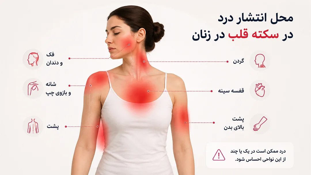 محل انتشار در در بدن زنان در سمته قلبی