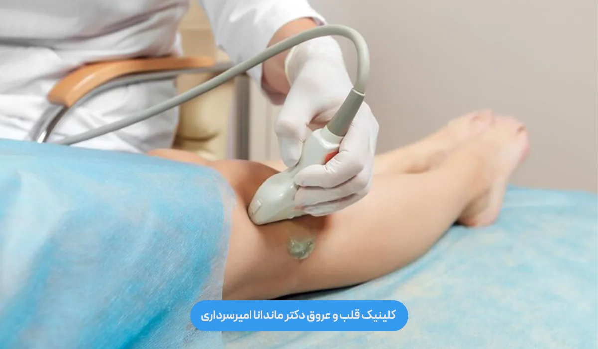 درمان واریس با لیزر (EVLA) دقیقاً چگونه انجام می‌شود؟